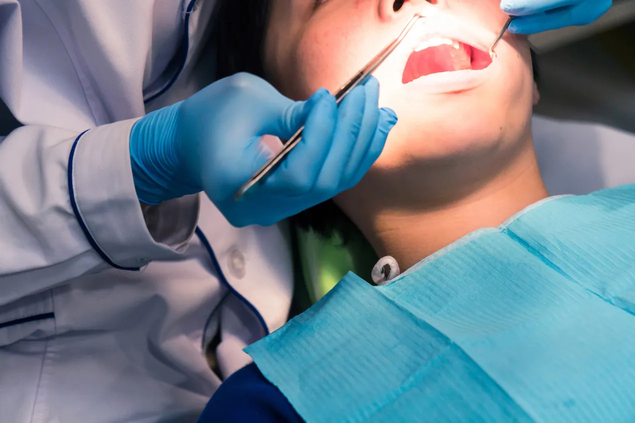 Hàm duy trì cố định sau niềng có cần thiết không? Ưu, nhược điểm